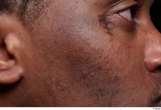 HD Face Skin Demarien Smith cheek face scar skin pores…
